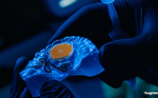 MouthPad^