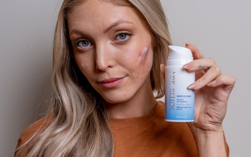 Soteri Skin 2-Step Eczema Starter Kit