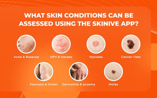 Skinive AI